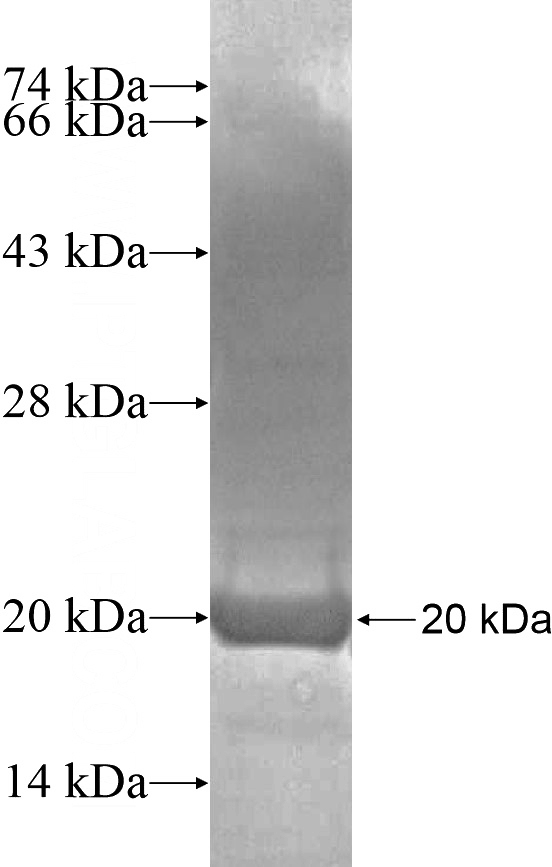Recombinant Human SLC1A4 SDS-PAGE