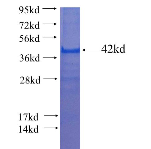 Recombinant Arabidopsis thaliana CKA1 SDS-PAGE
