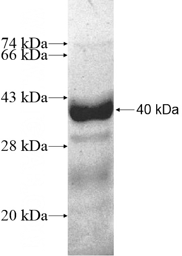Recombinant Human STX19 SDS-PAGE