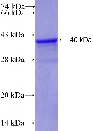 Recombinant Human KPNA1 SDS-PAGE