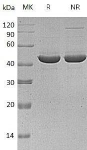 Human SERPINB3/SCCA/SCCA1 (His tag) recombinant protein