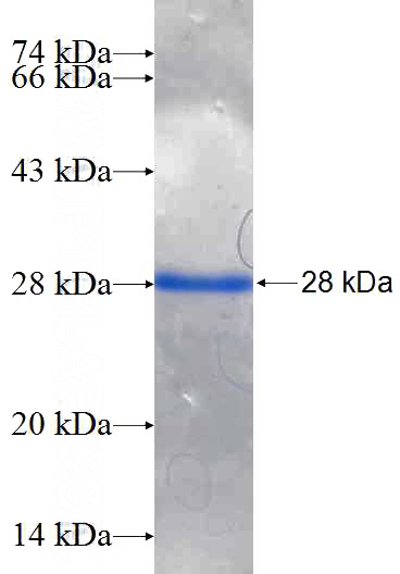 Recombinant Human PNOC SDS-PAGE
