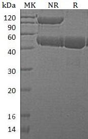 Mouse Ctse (His tag) recombinant protein