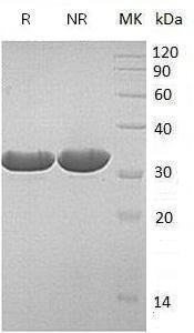 Human ECH1 recombinant protein
