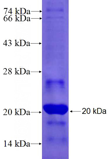 Recombinant Human SASH1 SDS-PAGE