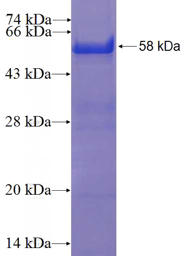Recombinant Human RAD1 SDS-PAGE