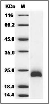 Mouse ESM1 / Endocan Protein (His Tag) SDS-PAGE
