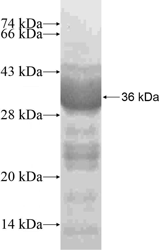 Recombinant Human KIAA1598 SDS-PAGE