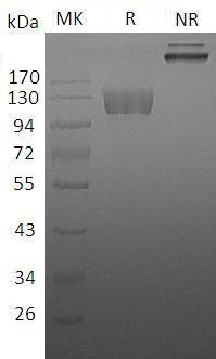 Human CSF1R/FMS (Fc tag) recombinant protein