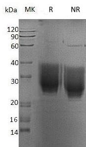Human BSG/UNQ6505/PRO21383 (His tag) recombinant protein