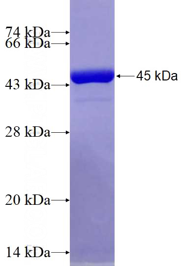 Recombinant Human CNOT1 SDS-PAGE