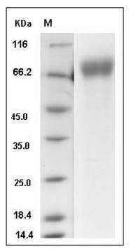 Human IFNAR1 / IFNAR Protein (His Tag) SDS-PAGE