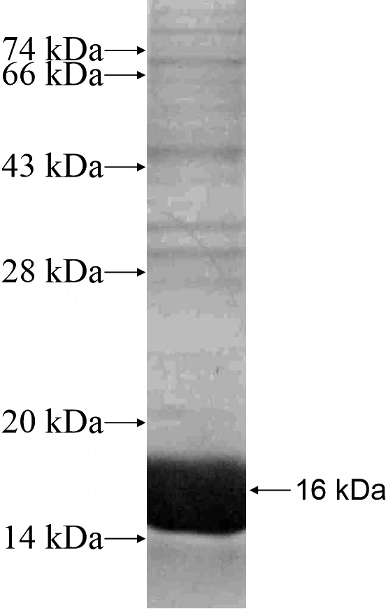 Recombinant Human TLE1 SDS-PAGE