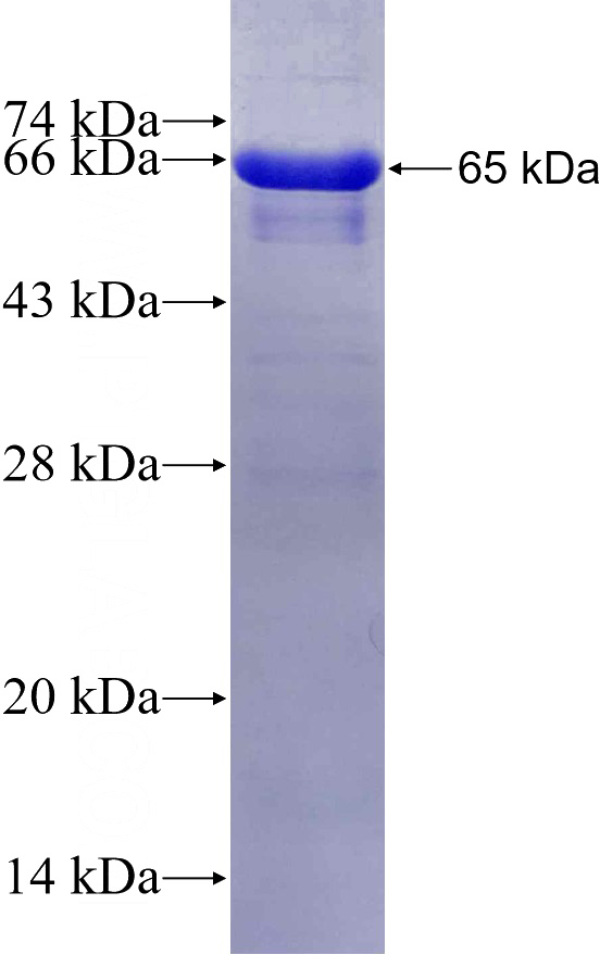Recombinant Human SH3D19 SDS-PAGE