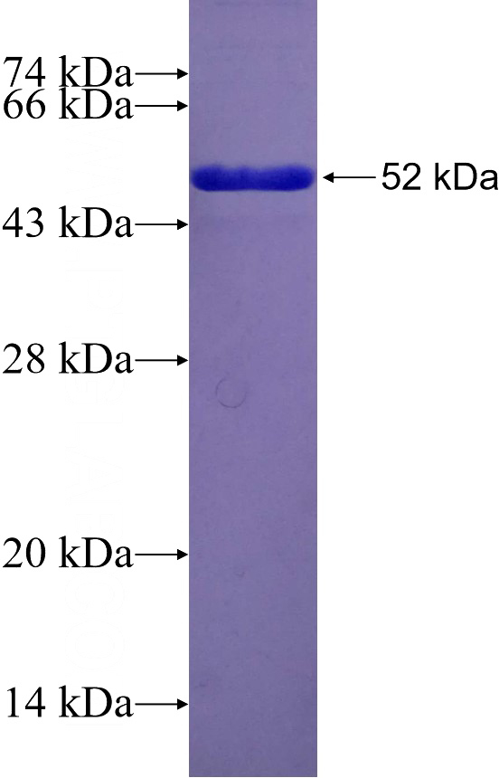 Recombinant Human KIF23 SDS-PAGE