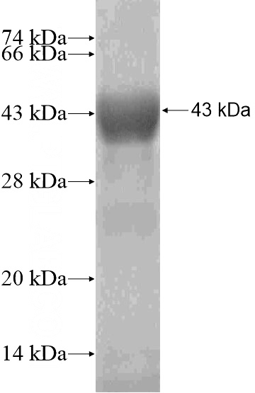 Recombinant Human ANKFY1 SDS-PAGE