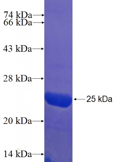 Recombinant Human EFHA2 SDS-PAGE
