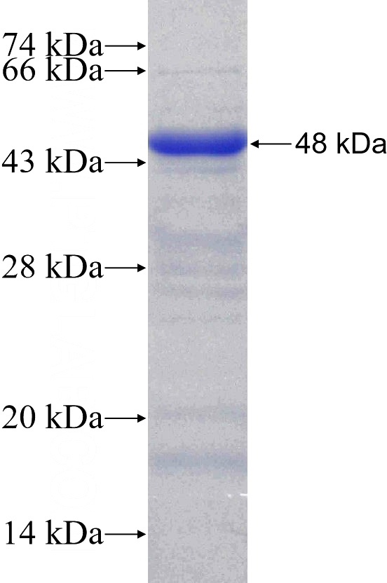 Recombinant Human PTK7 SDS-PAGE