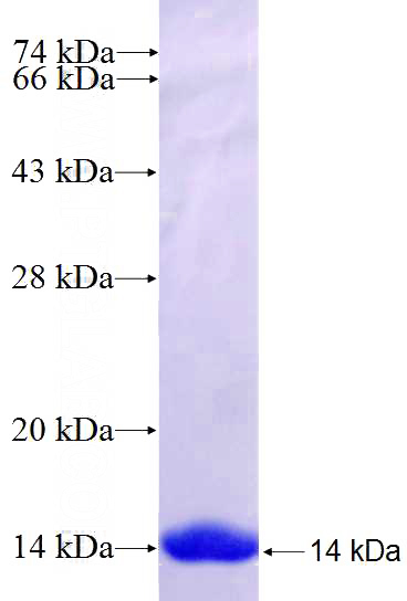 Recombinant Human KIAA0415 SDS-PAGE