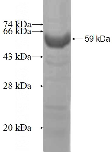 Recombinant Human RABEP1 SDS-PAGE
