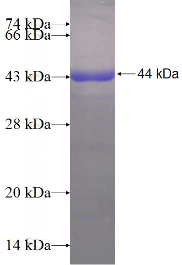 Recombinant Human ATG2A SDS-PAGE