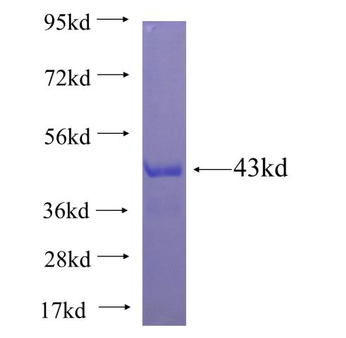 Recombinant human FSHR SDS-PAGE