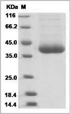 Rhesus CD122 / IL-2RB (His Tag) recombinant protein