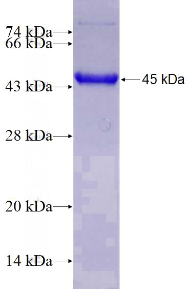 Recombinant Human RECQL4 SDS-PAGE