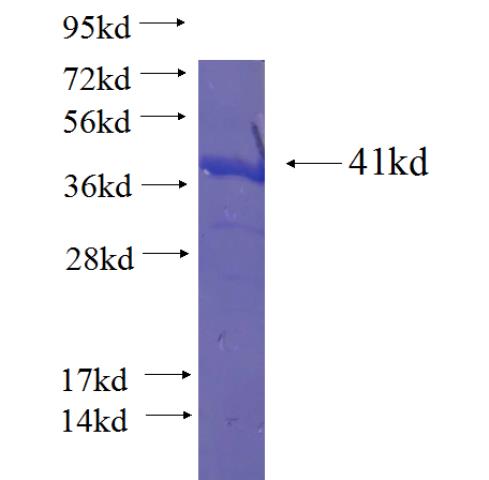 Recombinant human GPHN SDS-PAGE