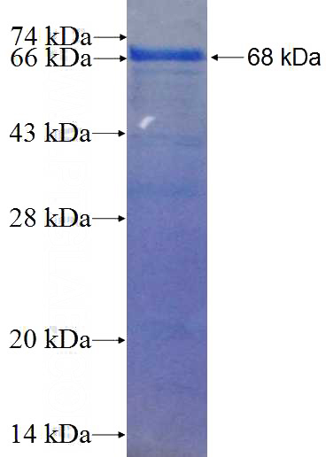 Recombinant Human Gamma adaptin SDS-PAGE