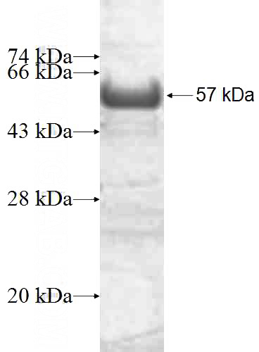 Recombinant Human AP1M1 SDS-PAGE