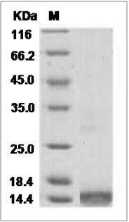 Human CCL16 / HCC-4 / NCC4 Protein (His Tag) SDS-PAGE