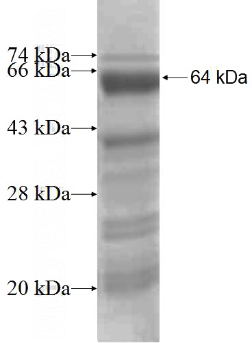 Recombinant Human DUSP9 SDS-PAGE
