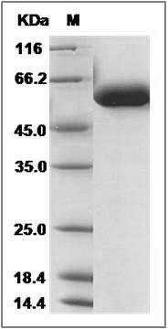 Human FUCA1 Protein (His Tag) SDS-PAGE
