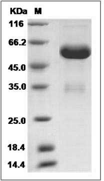Rat Layilin / LAYN Protein (Fc Tag) SDS-PAGE