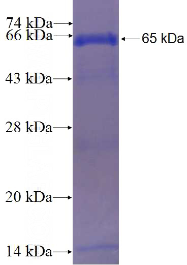 Recombinant Human PAPSS2 SDS-PAGE