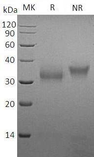 Mouse Sost (His tag) recombinant protein