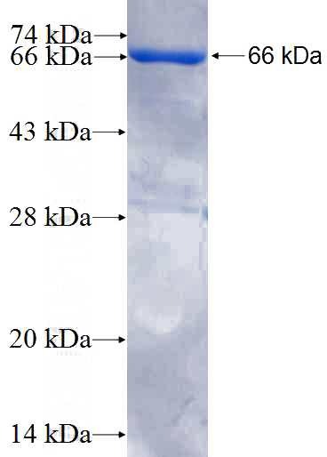 Recombinant Human NFKB1 SDS-PAGE
