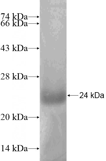 Recombinant Human KEPI SDS-PAGE