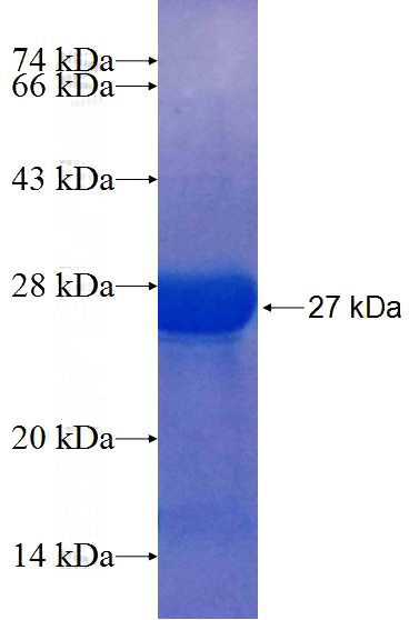 Recombinant Human RECK SDS-PAGE