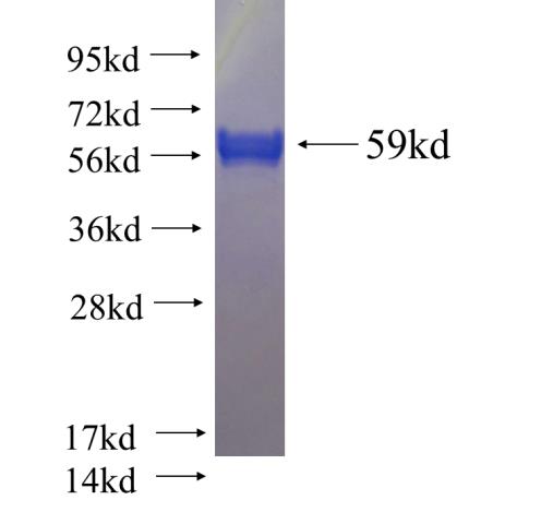 Recombinant human CNOT7 SDS-PAGE