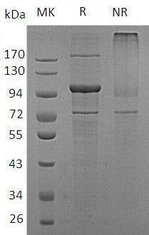 Human PI4KB/PIK4CB (His tag) recombinant protein