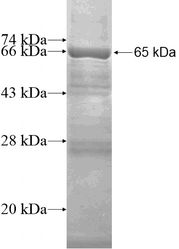 Recombinant Human PRPSAP2 SDS-PAGE