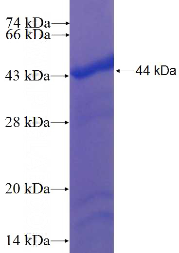 Recombinant Human CMPK2 SDS-PAGE