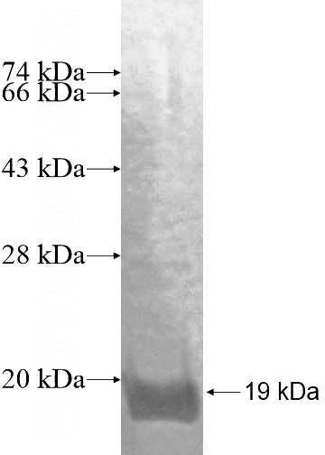 Recombinant Human ZNF343 SDS-PAGE