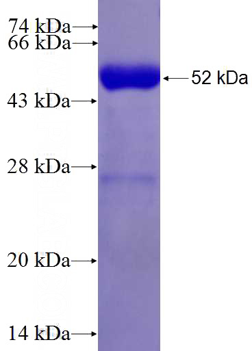 Recombinant Human RHOB SDS-PAGE