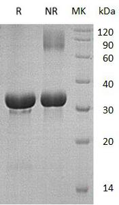 Human TRIM5/RNF88 (His tag) recombinant protein