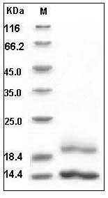 Human Cystatin E / CST6 Protein (His Tag) SDS-PAGE