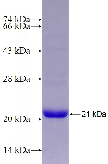 Recombinant Human FOXJ2 SDS-PAGE