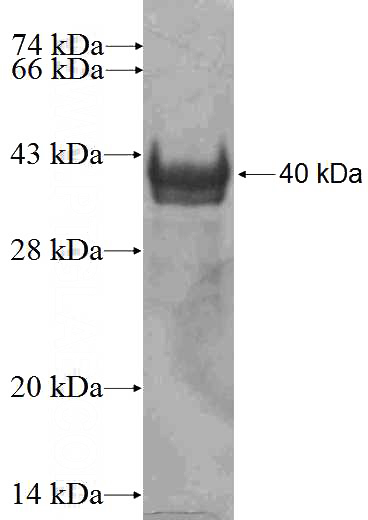 Recombinant Human ARPP-21 SDS-PAGE